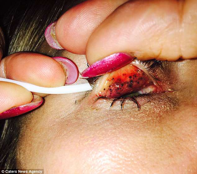 Bahaya maskara mata hampir buta membersihkan makeup. Sumber: Daily Mail